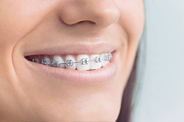 Best Wisdom Tooth Removal  in Westby, WI